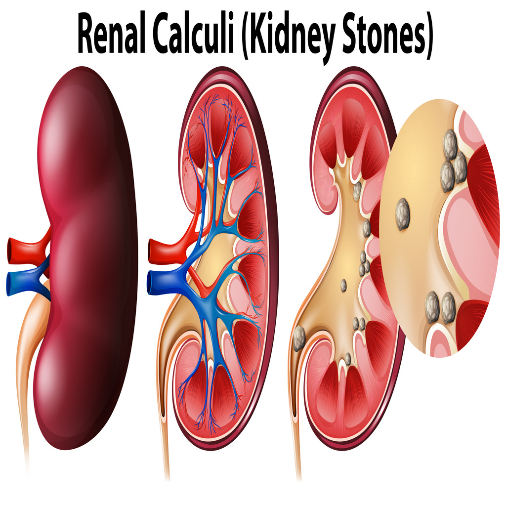 Renal Scintigraphy for Kidney Function Evaluation